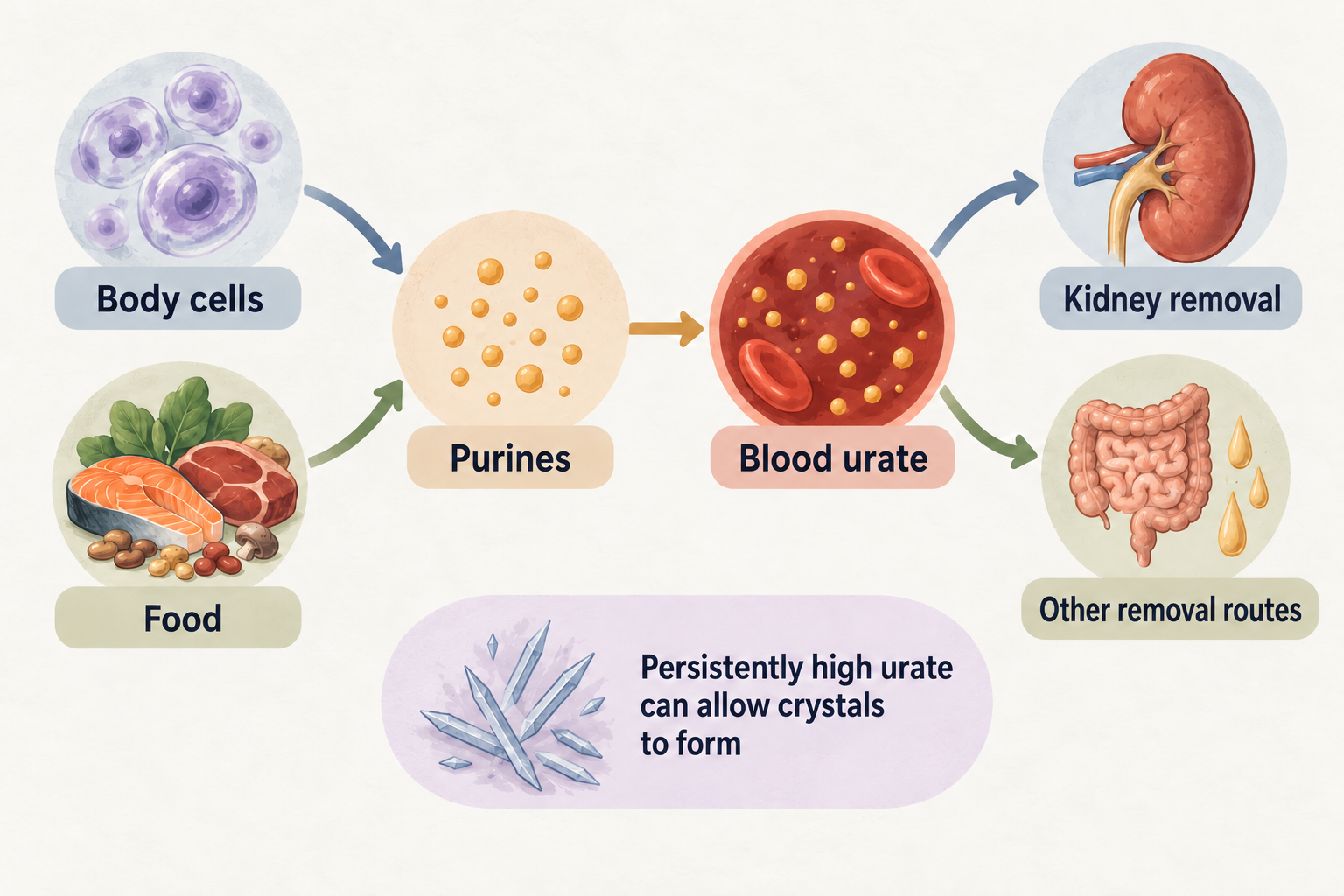 Body cells and food contribute purines, which lead to blood urate; separate arrows show kidney and other removal routes, with a conditional crystal-formation note.